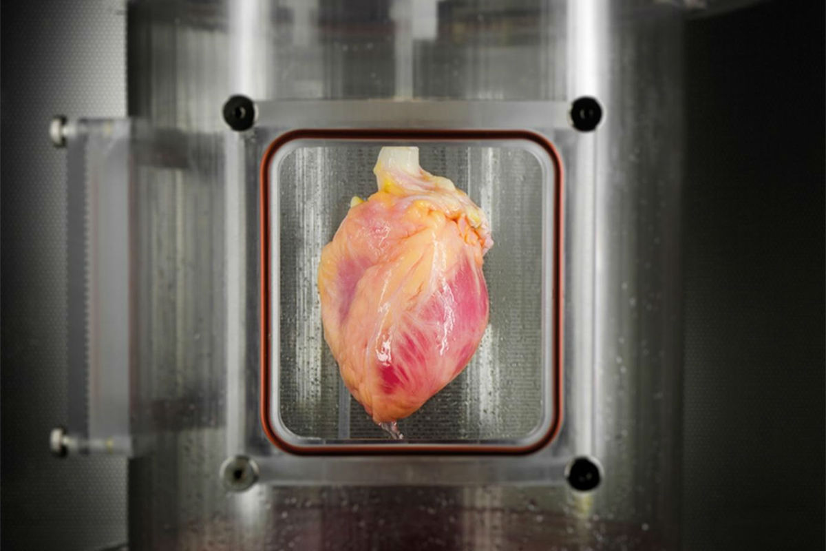 Учёные впервые вырастили целое сердце из стволовых клеток․  И оно бьётся!  Newsarium