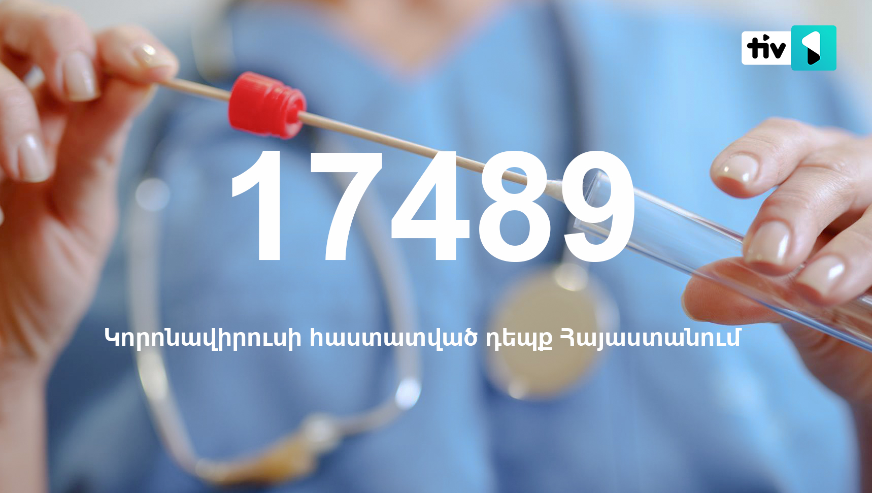 ՀՀ-ում կորոնավիրուսի դեպքերի թիվն աճել է 425-ով, բուժվածներինը՝ 295-ով, գրանցվել է մահվան 8 դեպք