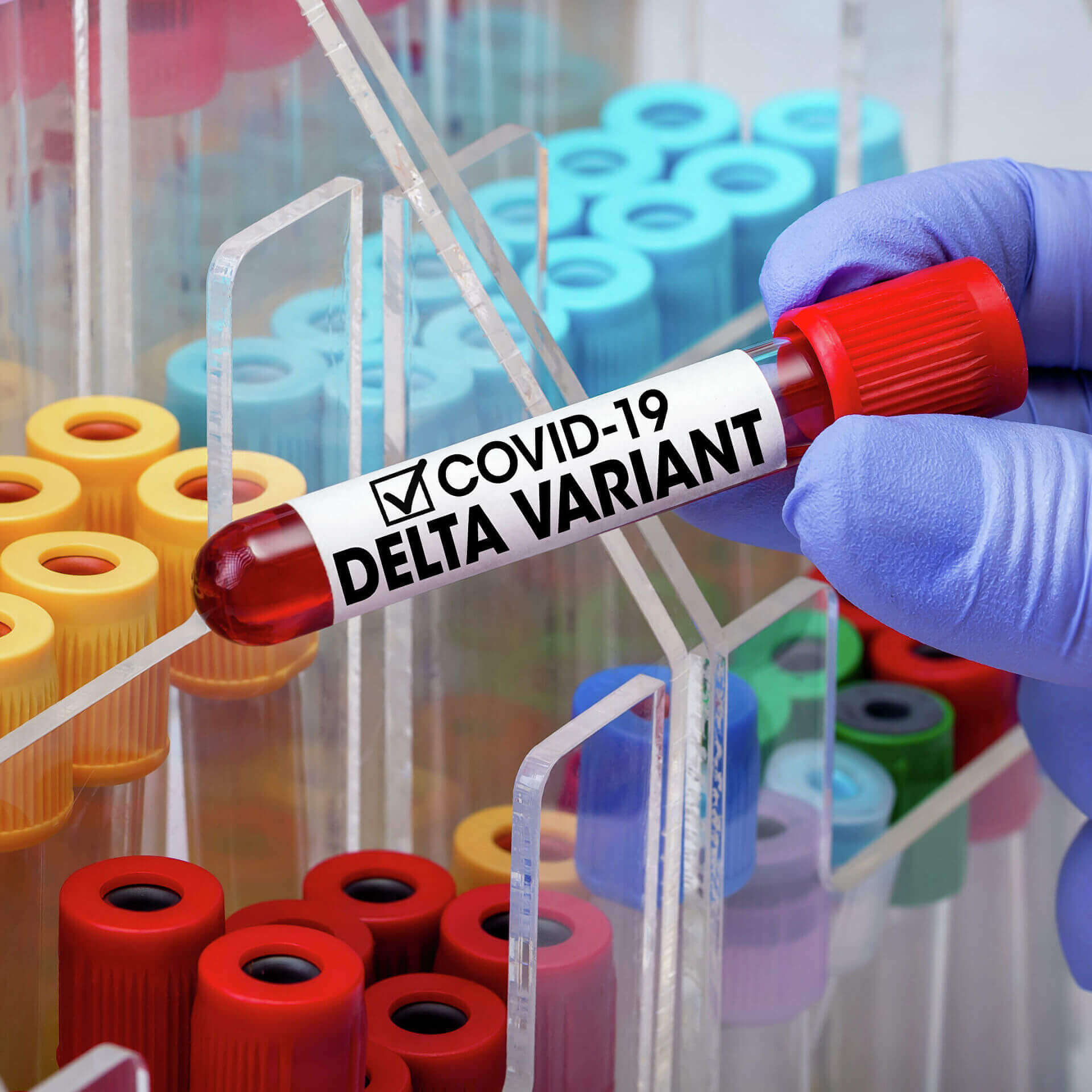 Կորոնավիրուսի «Դելտա» շտամը կարող է մնալ գերիշխող՝ դադարեցնելով զարգացումը