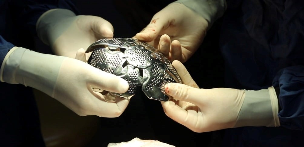 Կատարվել է աննախադեպ վիրահատություն «Սուրբ Աստվածամայր» ԲԿ-ում