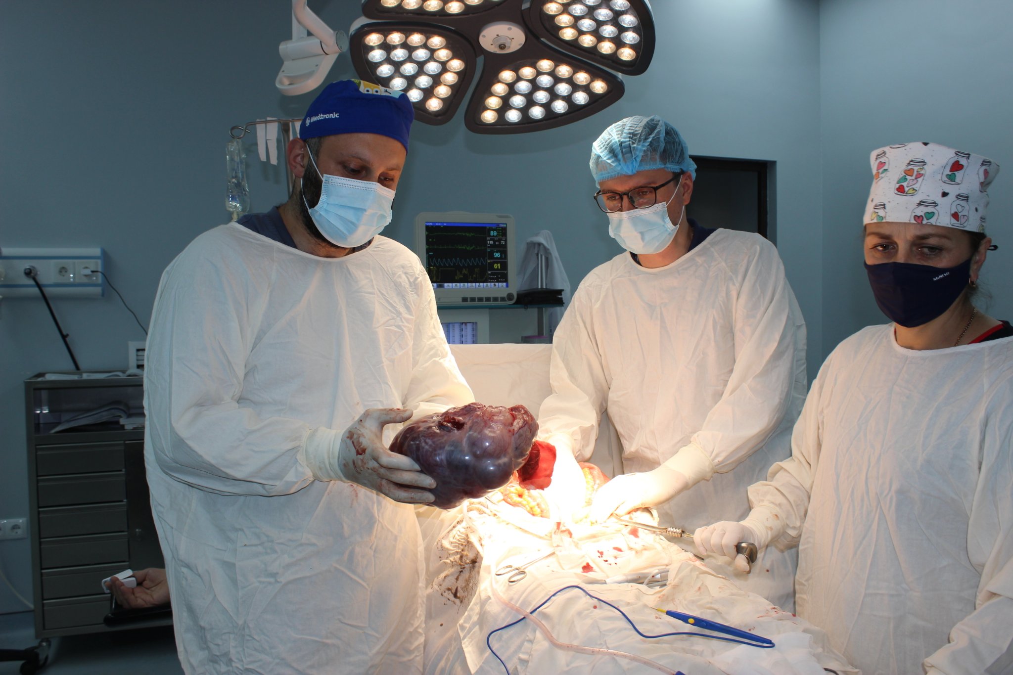 Հաստ աղու քաղցկեղի մետաստազ՝ ձվարանում. Վանաձորի ԲԿ-ում բարդ վիրահատություն է կատարվել