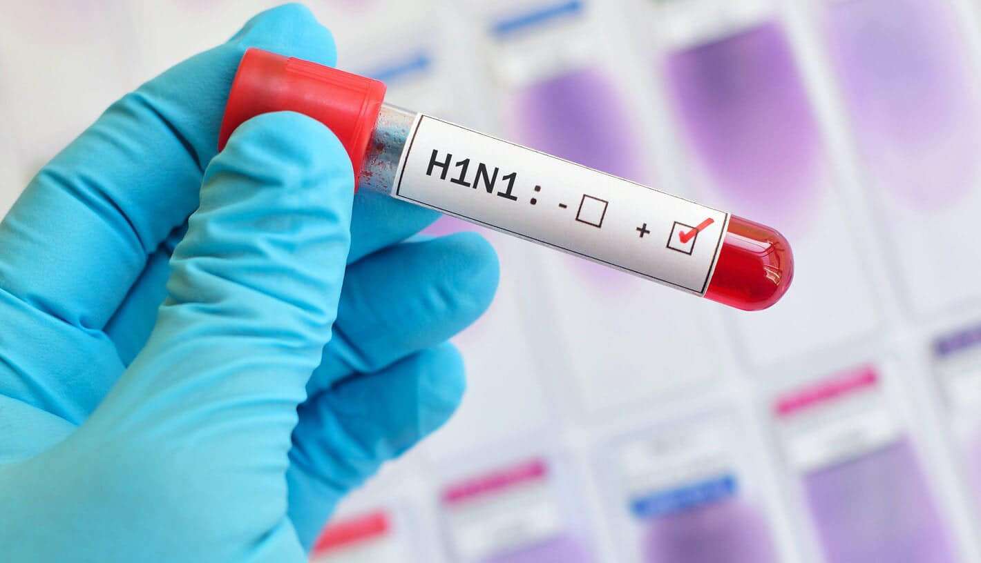 ՀՀ-ում հաստատվել է գրիպի Ա տեսակի H1N1 ենթատեսակի վիրուսի հարուցիչ