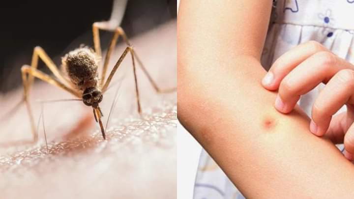 ՀՀ-ում հաստատվել է Արևմտյան Նեղոսի տենդով վարակման 58 դեպք